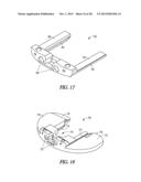 TIBIAL PROSTHESIS SYSTEMS, KITS, AND METHODS diagram and image