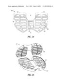 TIBIAL PROSTHESIS SYSTEMS, KITS, AND METHODS diagram and image