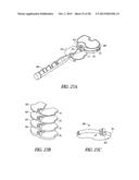 TIBIAL PROSTHESIS SYSTEMS, KITS, AND METHODS diagram and image