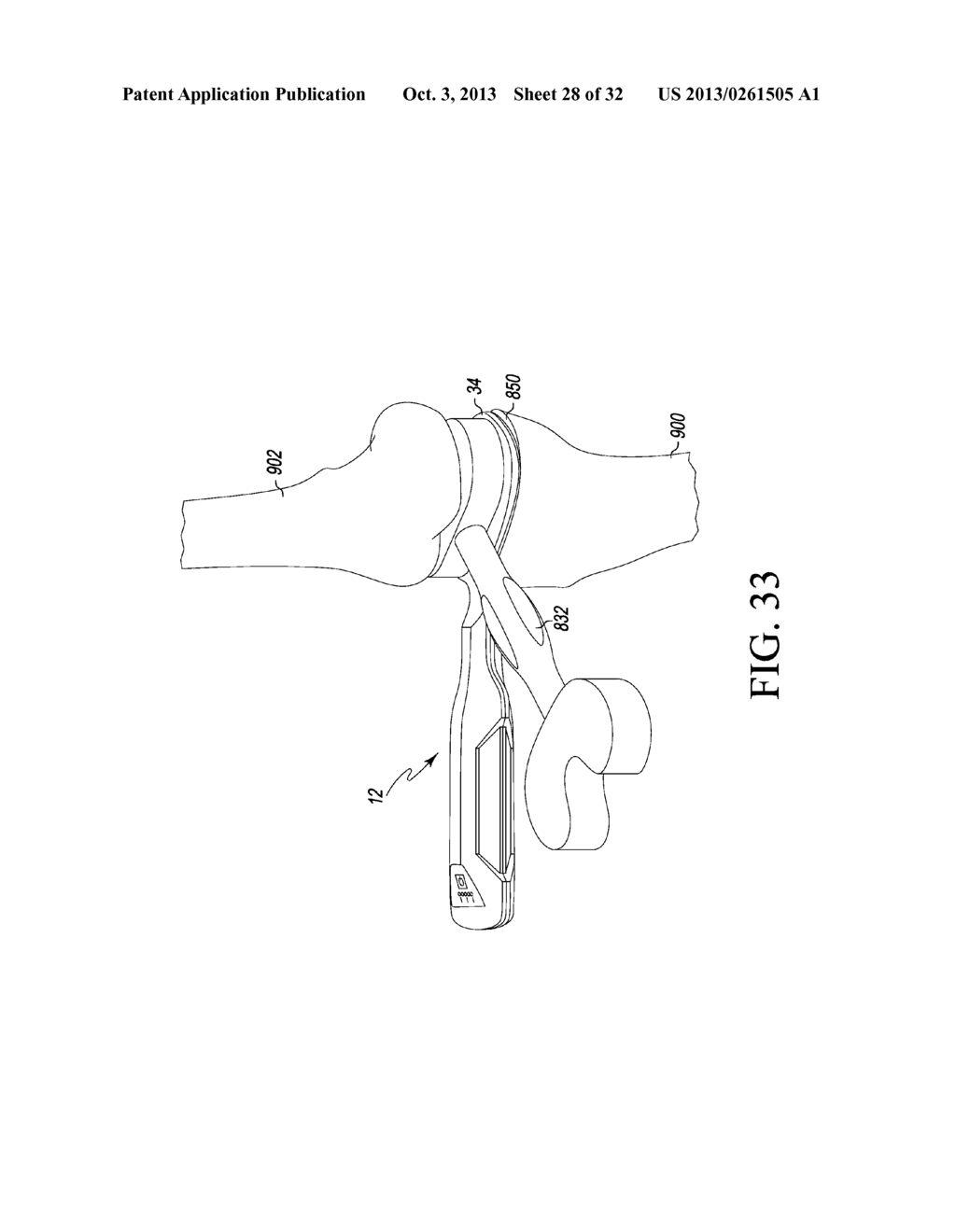 ORTHOPAEDIC SURGICAL SYSTEM FOR DETERMINING JOINT FORCES OF A PATIENT'S     KNEE JOINT - diagram, schematic, and image 29