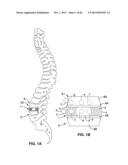 IMPLANTABLE THERMAL TREATMENT METHOD AND APPARATUS diagram and image