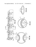 IMPLANTABLE THERMAL TREATMENT METHOD AND APPARATUS diagram and image