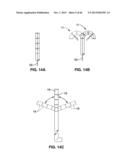 IMPLANTABLE THERMAL TREATMENT METHOD AND APPARATUS diagram and image