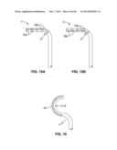 IMPLANTABLE THERMAL TREATMENT METHOD AND APPARATUS diagram and image