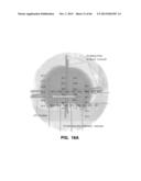 IMPLANTABLE THERMAL TREATMENT METHOD AND APPARATUS diagram and image