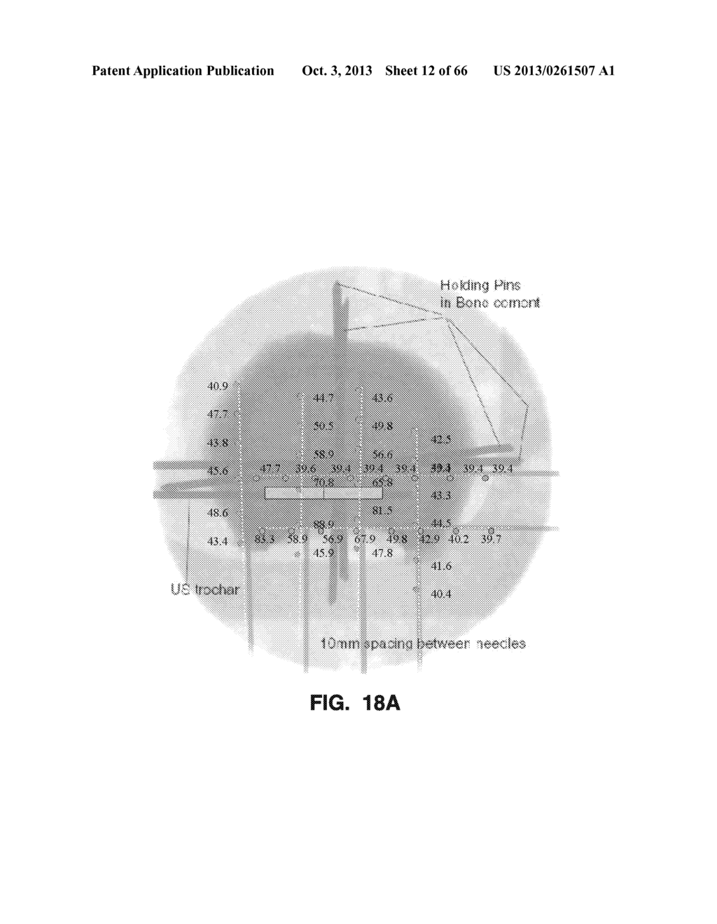 IMPLANTABLE THERMAL TREATMENT METHOD AND APPARATUS - diagram, schematic, and image 13