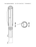 IMPLANTABLE THERMAL TREATMENT METHOD AND APPARATUS diagram and image