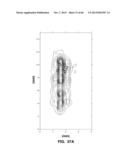 IMPLANTABLE THERMAL TREATMENT METHOD AND APPARATUS diagram and image