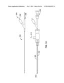 IMPLANTABLE THERMAL TREATMENT METHOD AND APPARATUS diagram and image