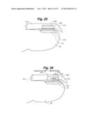 DIP JOINT EXTENSION SPLINT AND METHODS OF USING SAME diagram and image