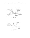 NITRIC OXIDE DELIVERY DEVICES diagram and image