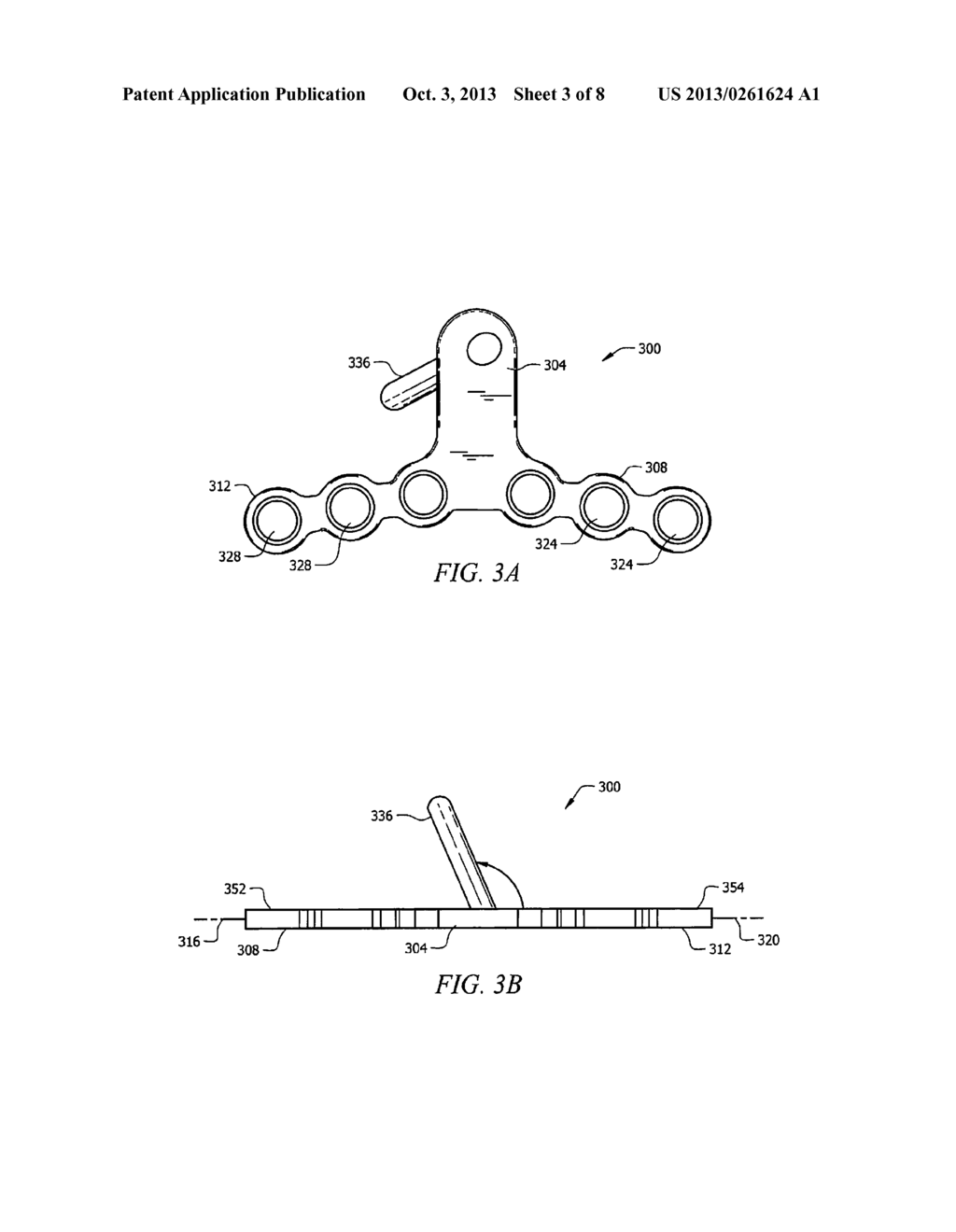 MAXILLARY IMPLANT FOR ADVANCEMENT, EXPANSION AND STABILIZATION OF     REPOSITIONED BONE SECTIONS - diagram, schematic, and image 04