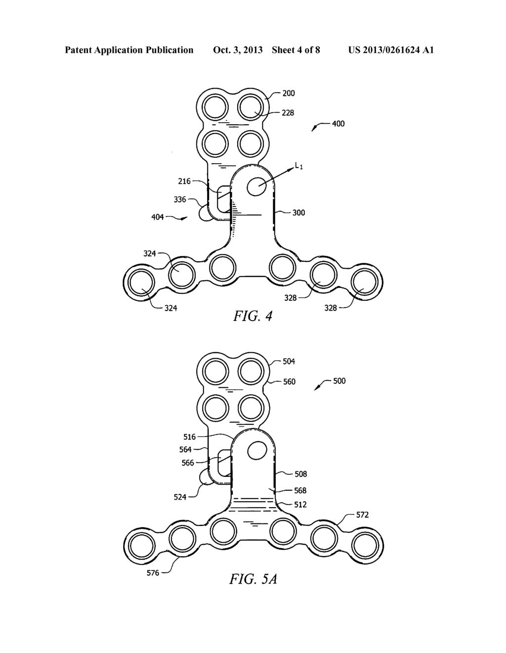 MAXILLARY IMPLANT FOR ADVANCEMENT, EXPANSION AND STABILIZATION OF     REPOSITIONED BONE SECTIONS - diagram, schematic, and image 05