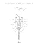 Rod Coercer diagram and image