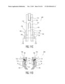 Rod Coercer diagram and image