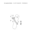 MANUAL SURGICAL LIGATION CLIP APPLIER diagram and image