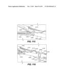 MANUAL SURGICAL LIGATION CLIP APPLIER diagram and image