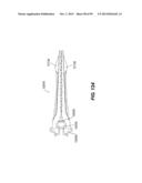 MANUAL SURGICAL LIGATION CLIP APPLIER diagram and image