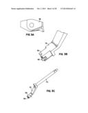 Apparatus and Method for Sternotomy Closure diagram and image