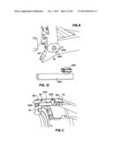 Apparatus and Method for Sternotomy Closure diagram and image