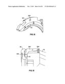 Apparatus and Method for Sternotomy Closure diagram and image