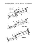 Apparatus and Method for Sternotomy Closure diagram and image