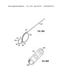 Apparatus and Method for Sternotomy Closure diagram and image