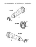 Apparatus and Method for Sternotomy Closure diagram and image