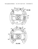 Apparatus and Method for Sternotomy Closure diagram and image