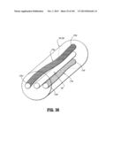 Flexible Endoscopic Stitching Devices diagram and image