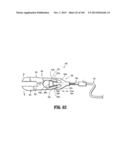 Flexible Endoscopic Stitching Devices diagram and image