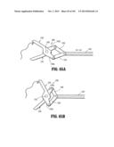 Flexible Endoscopic Stitching Devices diagram and image