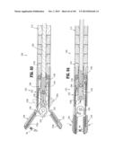 Flexible Endoscopic Stitching Devices diagram and image