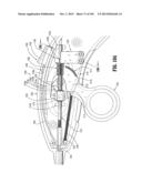 Flexible Endoscopic Stitching Devices diagram and image