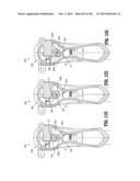 Flexible Endoscopic Stitching Devices diagram and image