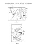 IMPLANT AND ASSOCIATED INSTRUMENTS AND METHODS diagram and image