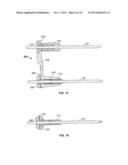 IMPLANT AND ASSOCIATED INSTRUMENTS AND METHODS diagram and image