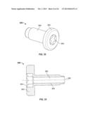 IMPLANT AND ASSOCIATED INSTRUMENTS AND METHODS diagram and image