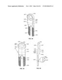 IMPLANT AND ASSOCIATED INSTRUMENTS AND METHODS diagram and image