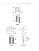 IMPLANT AND ASSOCIATED INSTRUMENTS AND METHODS diagram and image