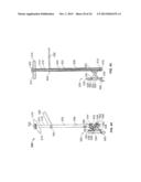 IMPLANT AND ASSOCIATED INSTRUMENTS AND METHODS diagram and image