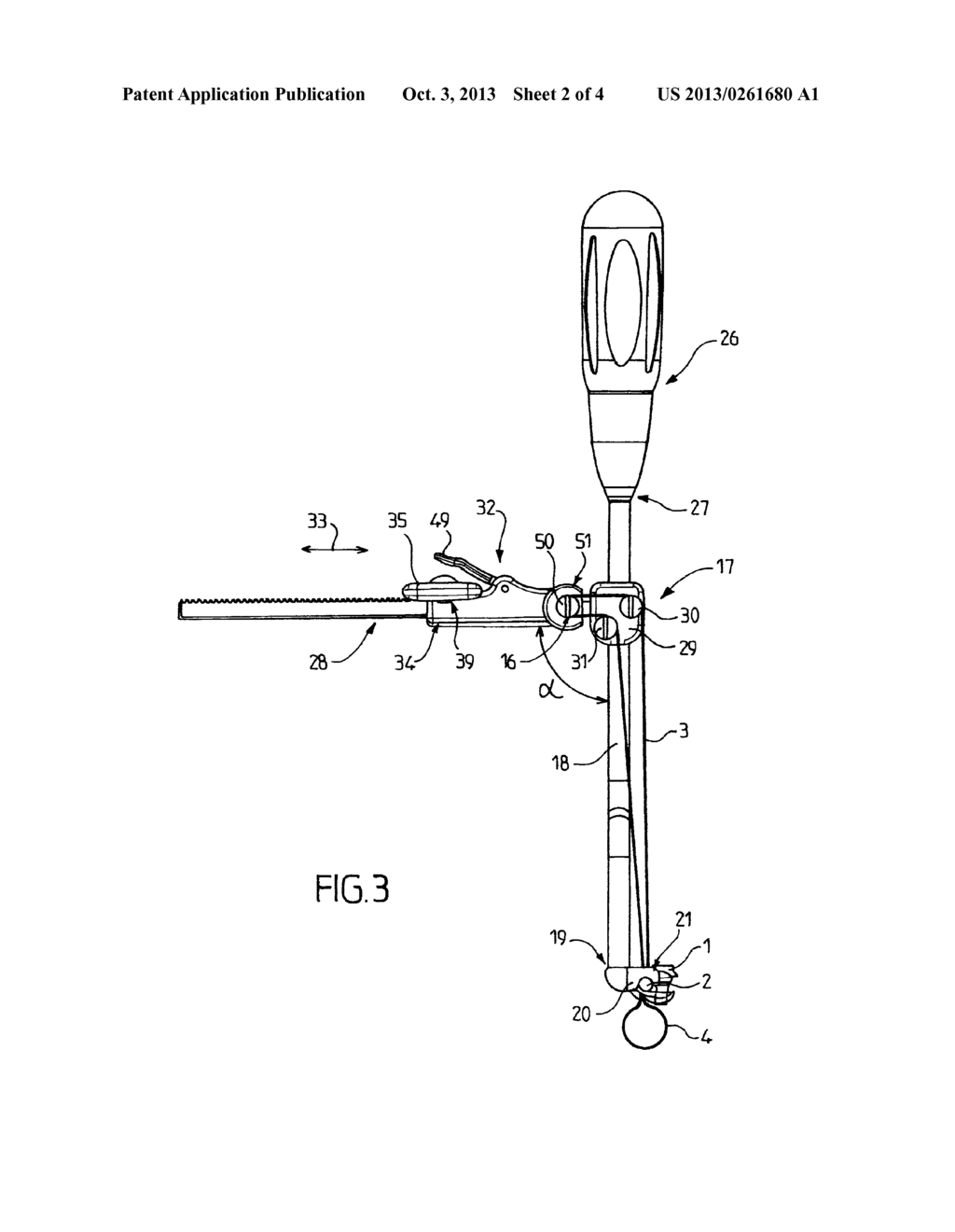 DEVICE FOR TENSIONING A FLEXIBLE BAND - diagram, schematic, and image 03