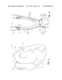 SYSTEM AND METHOD FOR NEURAL STIMULATION diagram and image