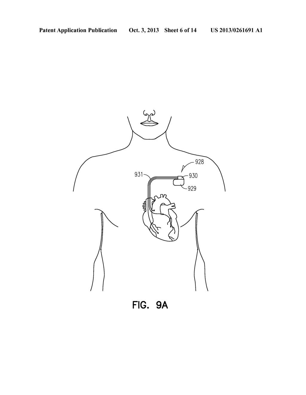 SYSTEM AND METHOD FOR NEURAL STIMULATION - diagram, schematic, and image 07