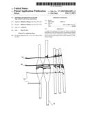 METHOD AND APPARATUS FOR THE TREATMENT OF FOCAL DYSTONIA diagram and image