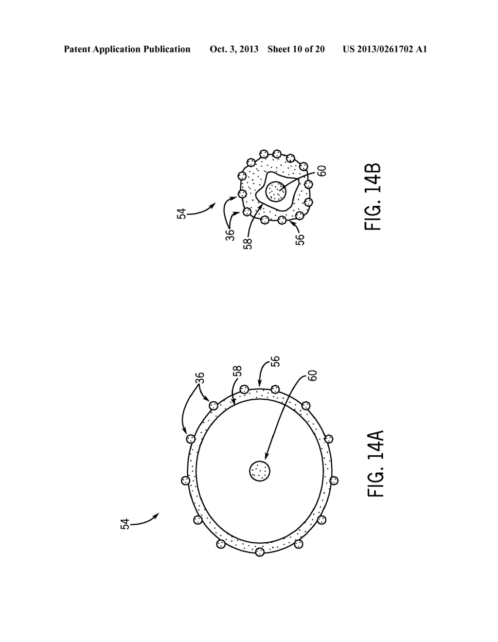 UTERINE ELECTRICAL STIMULATION SYSTEM AND METHOD - diagram, schematic, and image 11