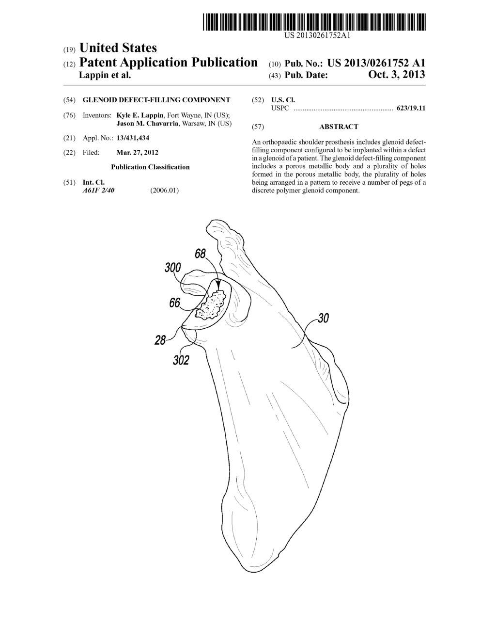 GLENOID DEFECT-FILLING COMPONENT - diagram, schematic, and image 01