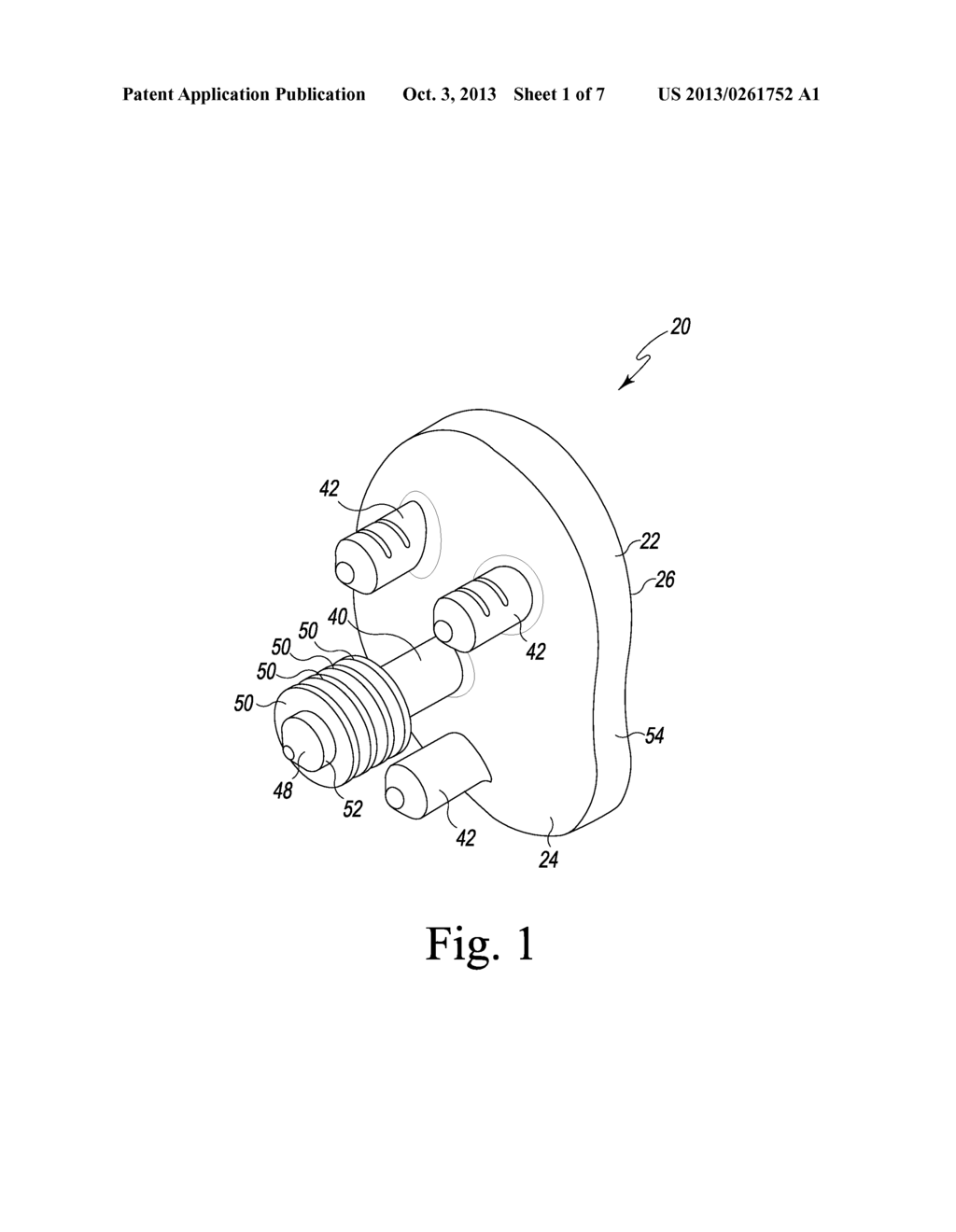 GLENOID DEFECT-FILLING COMPONENT - diagram, schematic, and image 02