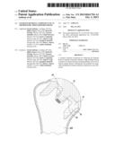 STEMLESS HUMERAL COMPONENT OF AN ORTHOPAEDIC SHOULDER PROSTHESIS diagram and image