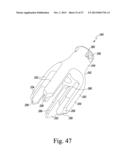 STEMLESS HUMERAL COMPONENT OF AN ORTHOPAEDIC SHOULDER PROSTHESIS diagram and image